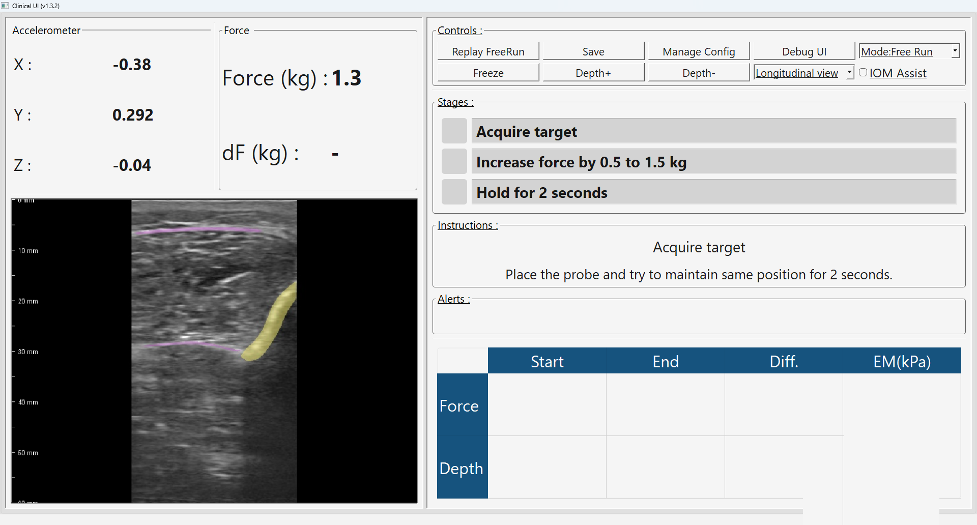 A&W clinical ultrasound application showing a B-mode image with AI-annotated tissue, probe force and motion readouts, a guided workflow, and measurements